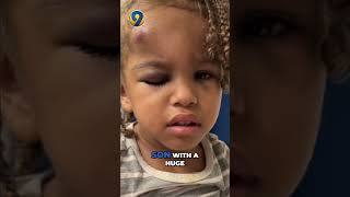 Mother seeks answers after 3-year-old son was injured at Concord daycare | WSOC-TV