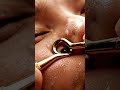 Golden Tool Blackhead Extraction ASMR | Ultra Close-Up Facial Cleaning #satisfying #asmr #skincare