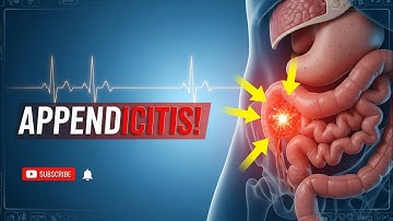 “Appendicitis EXPLAINED: What Happens Inside Your Body (3D Medical Animation)”