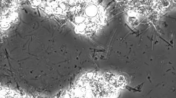 Human dental plaque sample viewed using an inverted microscope, in bright field phase contrast.