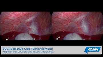 VIDEO ALGORITHMS MAKE THE DIFFERENCE