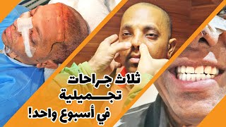 عملية ترميم الأنف وزراعة الشعر وفينير الأسنان برحلة واحدة!