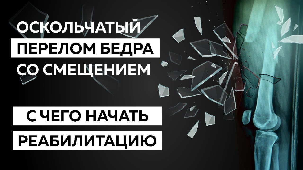 Реабилитация в домашних условиях после перелома бедра со смещением