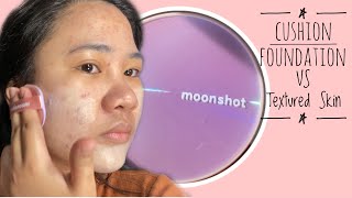 Moonshot Micro Glassyfit Cushion vs. Textured Skin with Acne