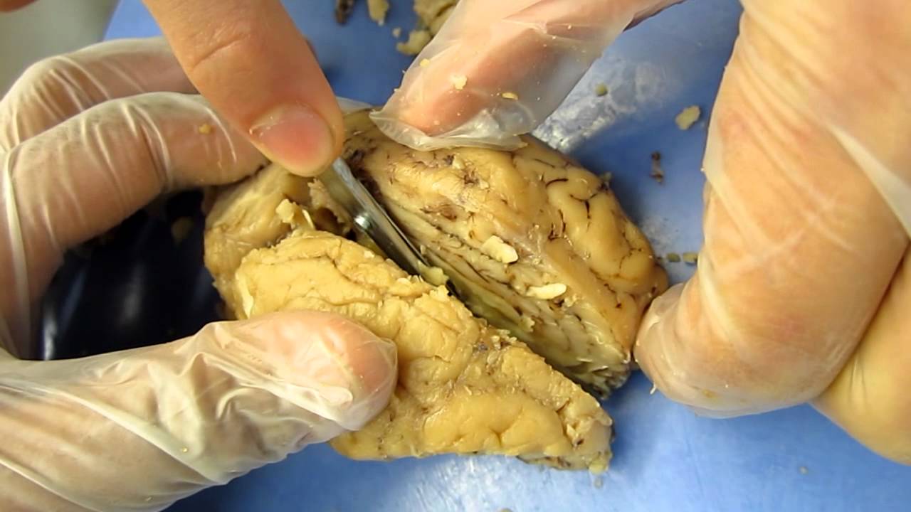Sheep Brain Mid-Sagittal Cut - YouTube