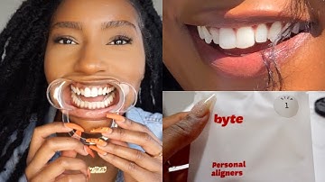 Fixing my TEETH!! Affordable Aligners to Straighten Teeth| My Byte Journey | iamLindaElaine