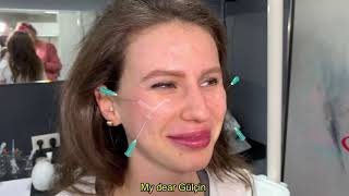 Dr. Nüket Eroğlu, Midface And Cheekbone Filler