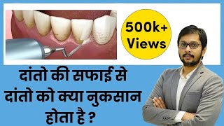 क्या दांतों की सफाई दांतों को नुकसान पहुंचाती है?  Does Cleaning/SCALING damage teeth? by Dr Ankit