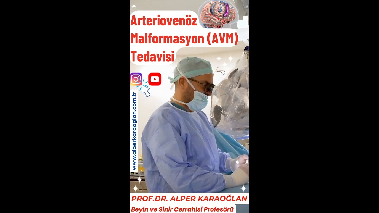 Arteriovenöz Malformasyon (AVM) (Damar Yumağı / Damar Yumaklanması) Tedavisi