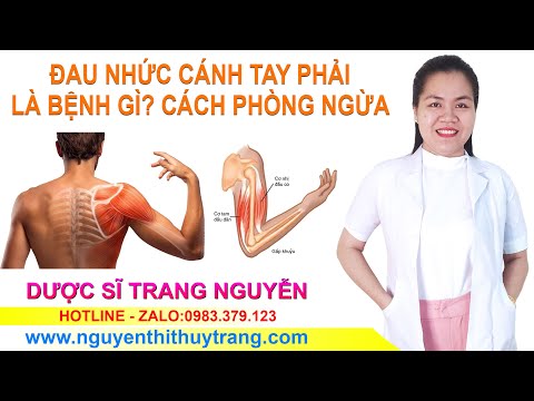 Đau nhức cánh tay phải là bệnh gì? Có nguy hiểm không?