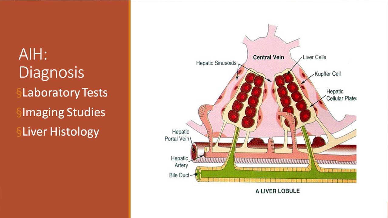 Autoimmune Hepatitis in Children: Approach to Treatment and What to Expect