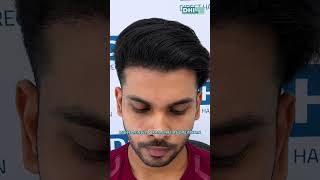 From Hair Loss to Transformation | Real DHI® Result