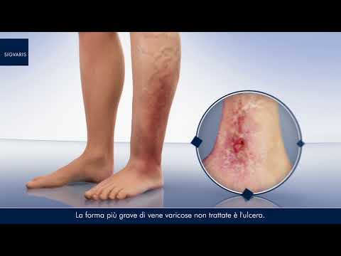 Video: Cos'è la malattia delle gambe nere - Trattamento per la malattia delle gambe nere in giardino