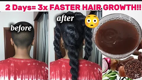 Spray It On Your Hair For Just Two Days And Your Hair Will Grow 3 Times Faster ✅
