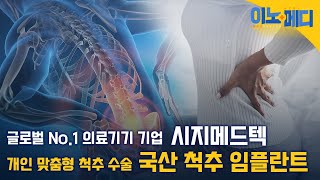 [이노메디 24회] &#39;개인 맞춤형&#39; 척추 수술 시대, 국산 &#39;척추 임플란트&#39;