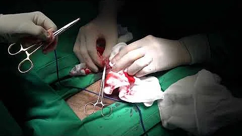 Como é realizada a cirurgia de postectomia?