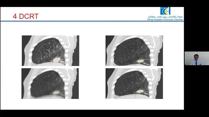 Image Guidance in Radiation Oncology Practice | Dr. Jamal Khader