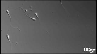 Progesterone "Hyperactivates" Sperm
