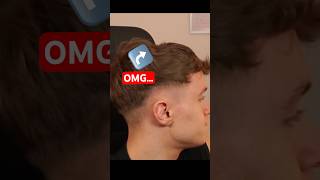 Streamer Reveals Headset Dent… 😱 #streamer #headsetdent