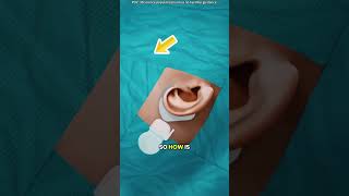 Celebrity How cochlear implant works?(3D animation) Net Worth