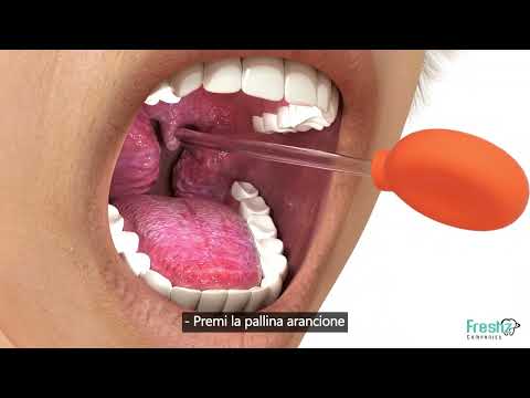Video: I calcoli tonsillari cadranno da soli?