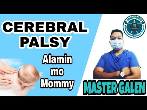 Video: Ano ang mga palatandaan ng cerebral palsy sa isang sanggol?