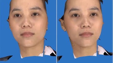 NÂNG MŨI S LINE TẠO DÁNG MŨI ĐẸP NHƯ SAO HÀN