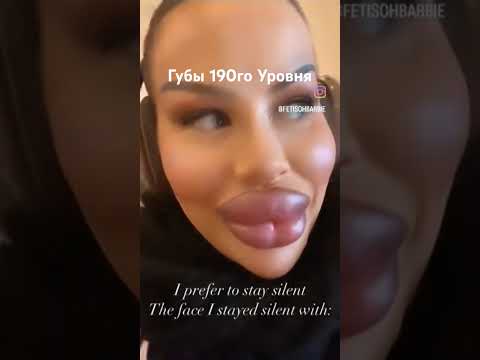 Ну вы поняли🤣 #красота #губы #развлечения  #пластика