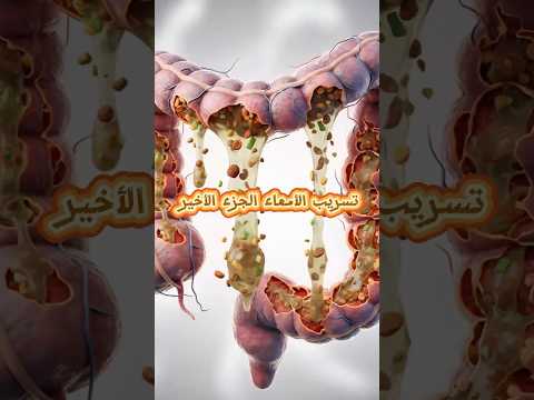 علامات الشفاء من تسريب الأمعاء ازاي تعرف إنك خفيت فعلا