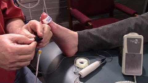 How to perform a TBI Toe Brachial Index with simpleABI PPG Kit