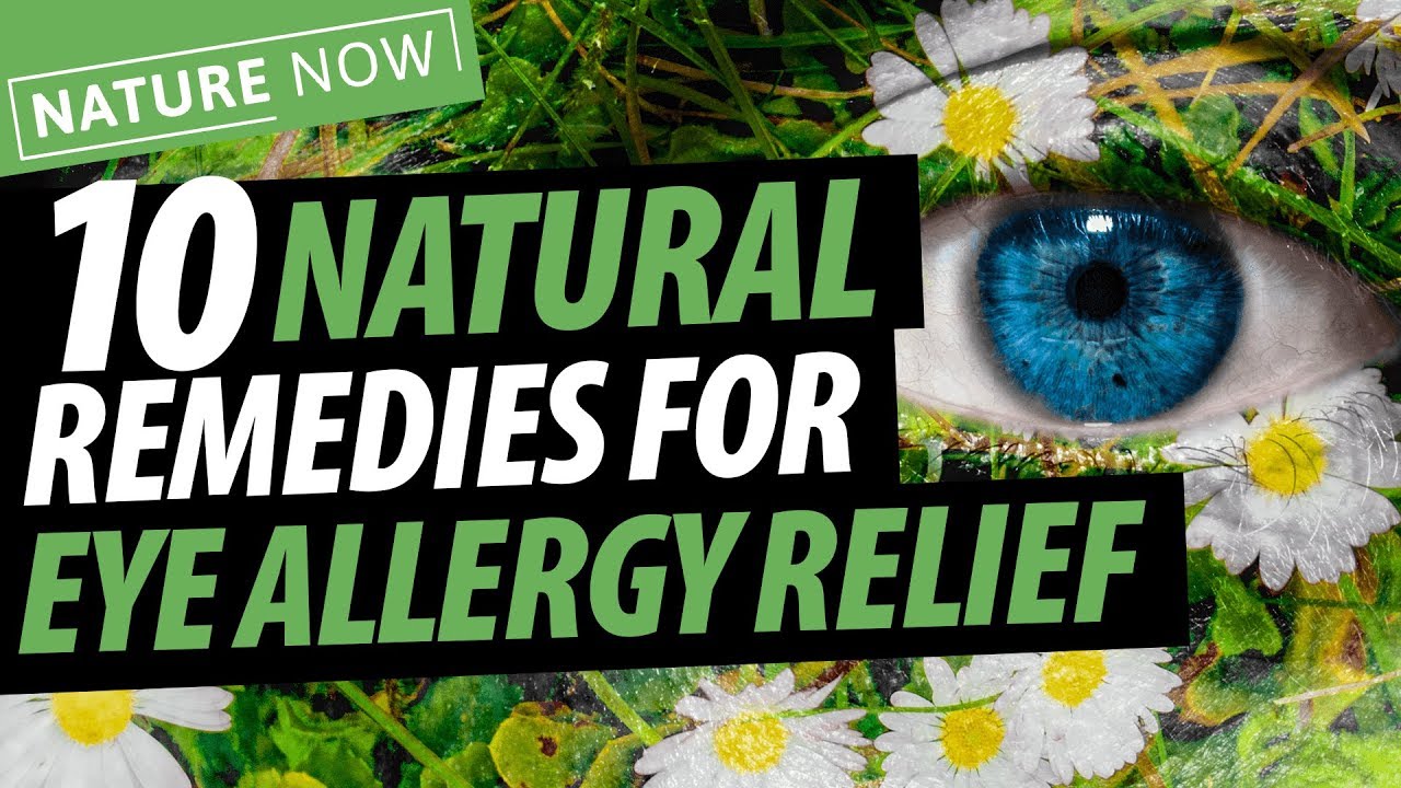 10 Natural Remedies For Eye Allergy Relief Youtube