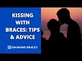 Can I Kiss with Braces? Tips and Advice