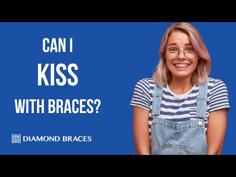 Video: Can I Kiss With Braces On My Teeth?