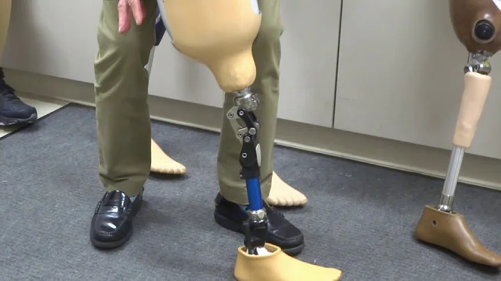 Prosthetic Knees w/ Doctor U Wanna Know (ep. 6)