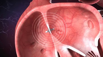 The Man With A Computer In His Heart - BBC Click