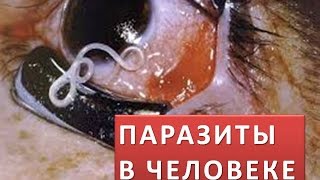 Паразиты в человеке Кошмар! Документальный фильм Паразиты в человеке Кошмар! Документальный фильм