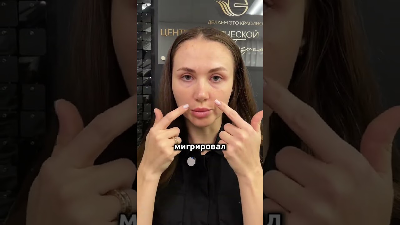 Филлеры сделали только хуже | Почему иногда косметология не работает — полный разбор в TG @bergmane