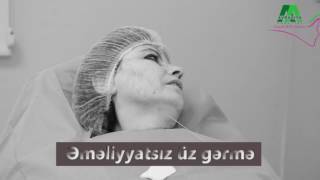 Əməliyyatsız Üz Gərmə Dermatoloq Dr Nigar Rasulova Avrasiya Hospital