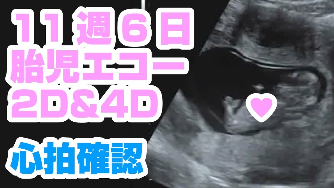 胎児エコー動画2d 4d 11週6日め Baby Echo 2d 4d 11w6d 心拍確認 Youtube