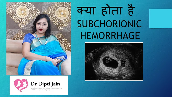 क्या होता है SUBCHORIONIC HEMORRHAGE IN PREGNANCY (HINDI) - DayDayNews