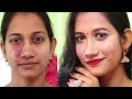 Girl sees herself for first time without her birthmark | The Power of Makeup