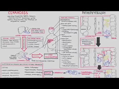 Liver Cirrhosis (SandS, Pathophysiology, Investigations, Management)