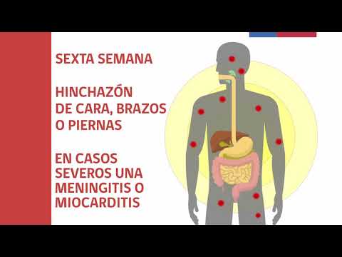 Vídeo: Triquinosis: Diagnóstico, Síntomas, Tratamiento De La Enfermedad