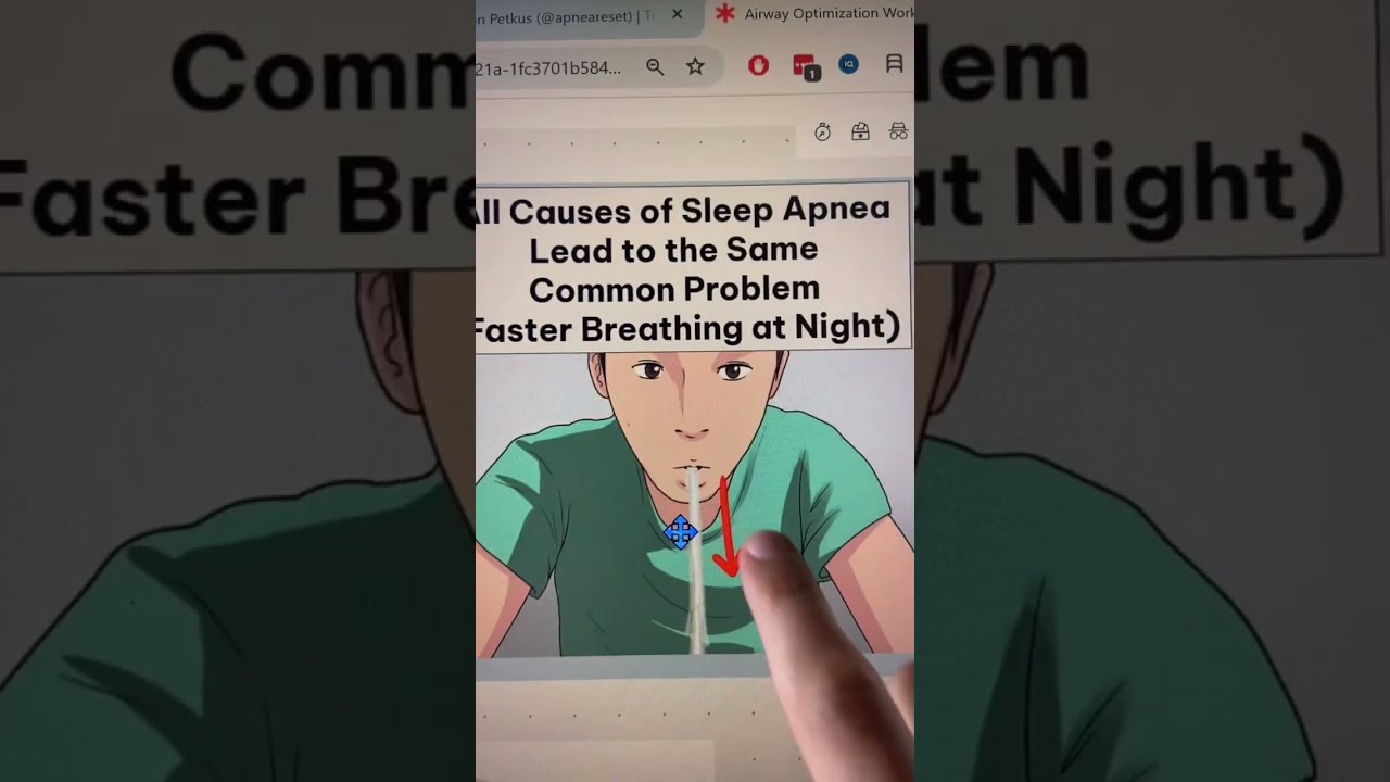 1 Shocking Cause Of Sleep Apnea