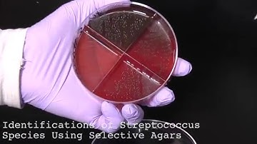 9. How to Identify Streptococcus Species Using Selective Agars