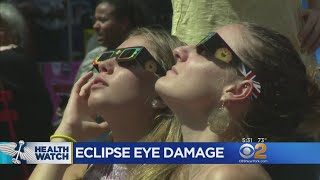 How To Tell If You Suffered Eye Damage During The Eclipse