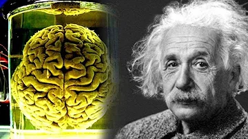 Why are Albert Einsteins eyes in a safe?