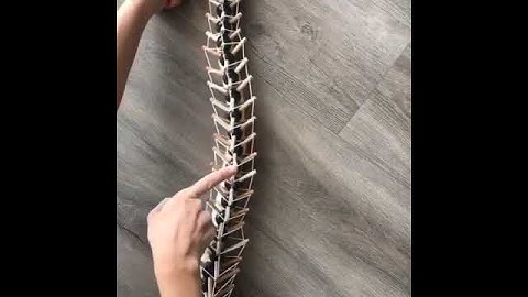 (Bio)Tensegrity & Spine