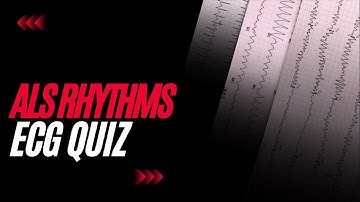 ALS Rhythms: ECG Quiz