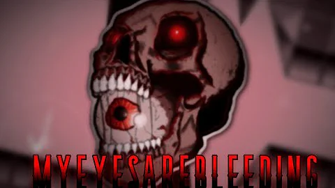 (iSpyWithMyLittleEye Remake) ~ MYEYESAREBLEEDING